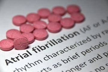 Guidelines for managing atrial fibrillation: New findings